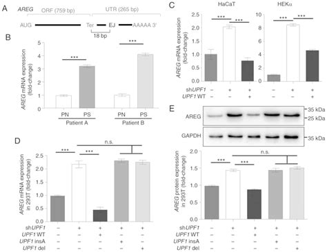 Aberrant Expression Of The UPF1 RNA Surveillance Gene Disturbs