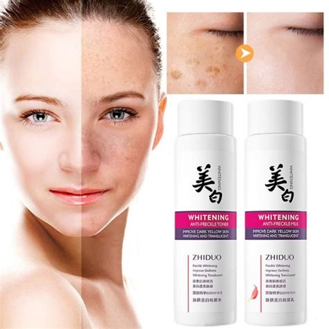 Effective Melasma Cream Remove Dark Spot Nicotinamide Whitening Freckle