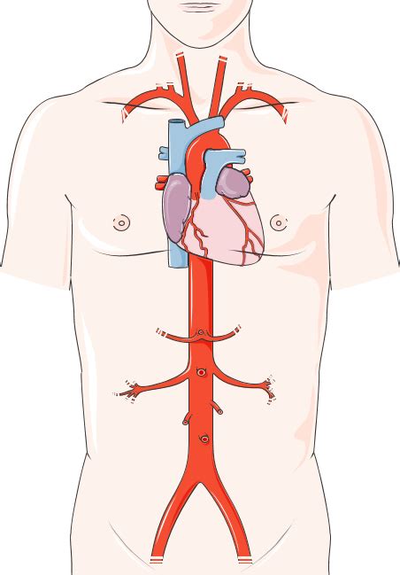 An Vrismes De Laorte L Institut Du Thorax Nantes