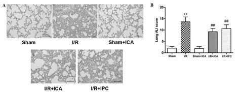 Protective Effects Of Icariin‑mediated Sirt1 Foxo3 Signaling Pathway On