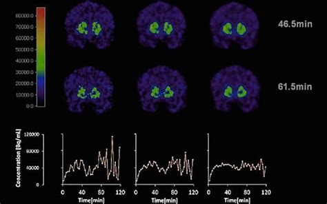 Brain Movies Show Nicotine Affects Men And Women Differently The