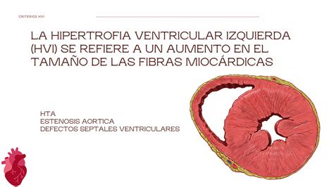 Solution Criterios Hipertrofia Ventricular Izquierda Bloqueos De