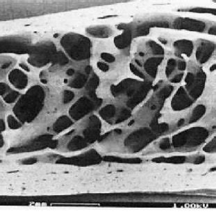 Microscopical Structure Of Cortical Bone A D Sketch Of Cortical