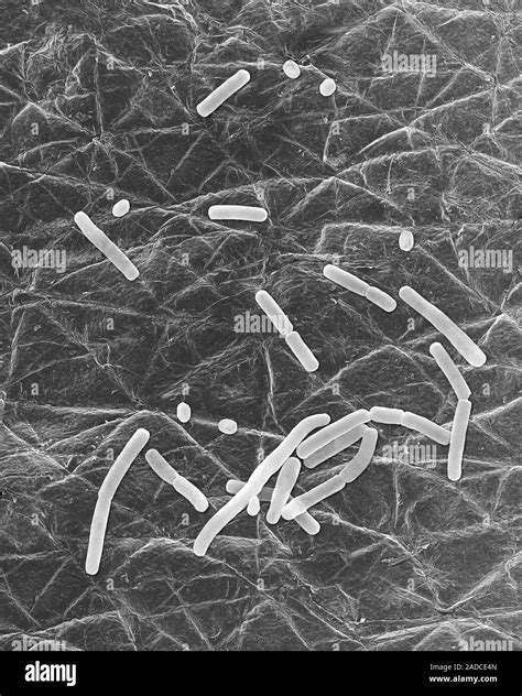 Scanning Electron Micrograph Sem Of Bacillus Anthracis Spore And