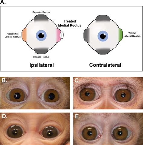 (A) Rectus extraocular muscles and the experimental design. One medial ...