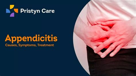 Appendicitis - Causes, Symptoms & Treatment | PPT