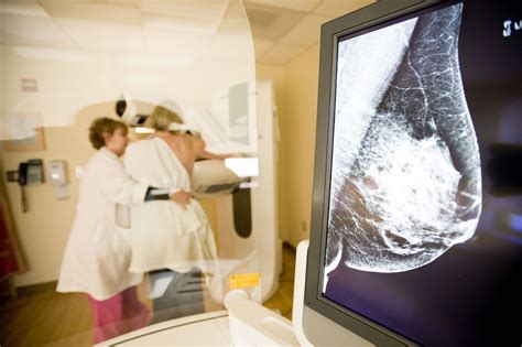 New Dimension Of Detection 3 D Mammography Technology Gains Ground