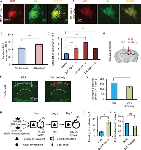 Deletion of Dcf1 Reduces Amyloid β Aggregation and Mitigates Memory