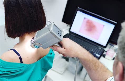 Melanoma Maligno Cos Sintomi Cause Diagnosi E Trattamento