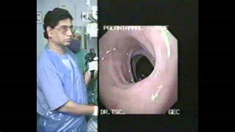 Upper G I Endoscopy Basic Techniques Youtube