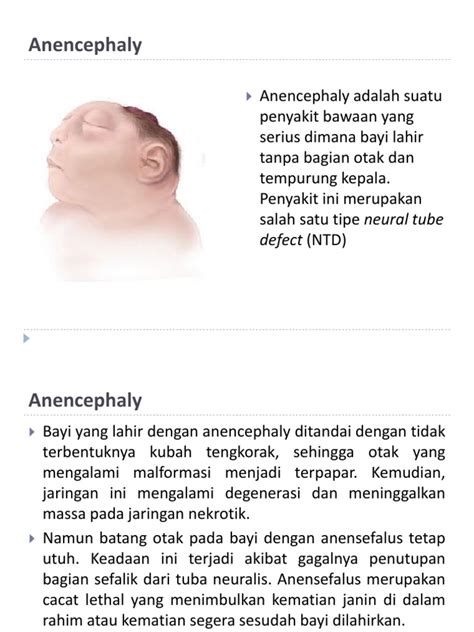 Faktor Risiko Dan Diagnosis Prenatal Anencephaly Pdf