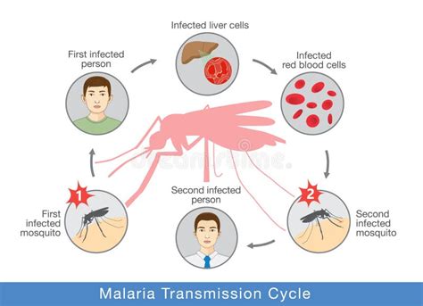 Malaria Clinical Features Diagnosis Management Prevention And Complications