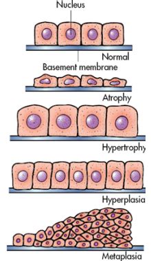 Cellular Adaptations In Health And Disease Flashcards Quizlet