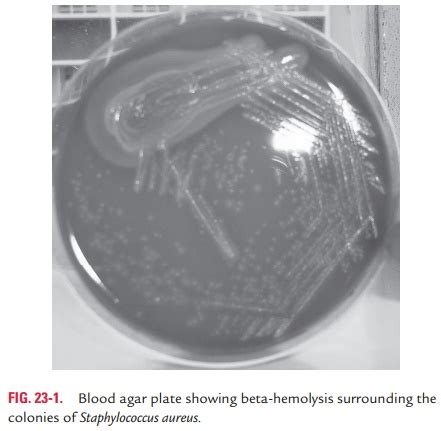 Staphylococcus Aureus Hemolysis On Blood Agar