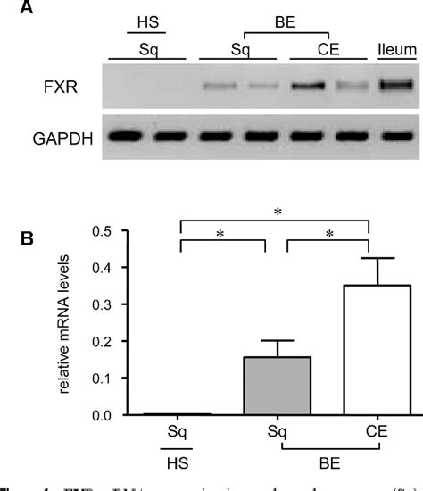 Figure 1 From Bile Acid Stimulated Expression Of The Farnesoid X