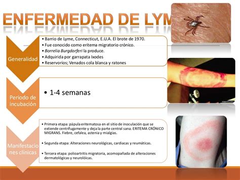 Enfermedad De Lyme