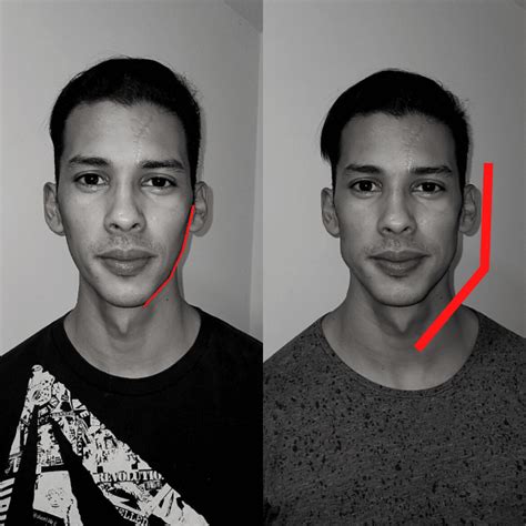 Mewing Tutorial Resultados E Antes E Depois Exercícios Para O Rosto