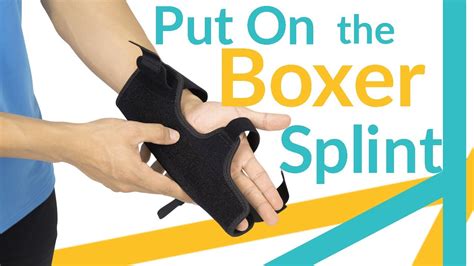 Ulnar Gutter Splint Metacarpal And Boxer's Fracture, 41% OFF