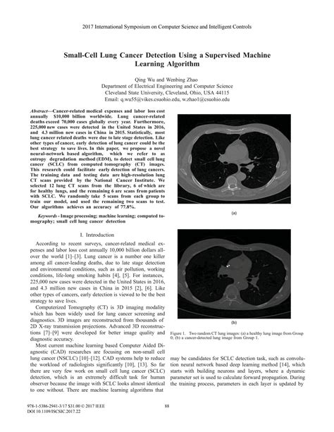 Solution Lung Cancer Detection Using Machine Learning Algorithm