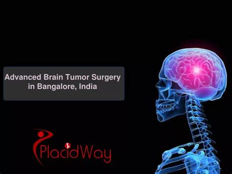 Ppt Advanced Brain Tumor Surgery In Bangalore India Powerpoint