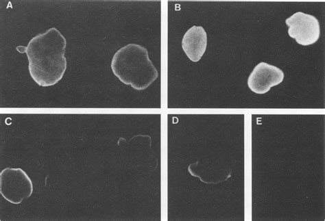 Immunofluorescence Microscopy Of E Histolytica Hm1imss Trophozoites Download High Quality