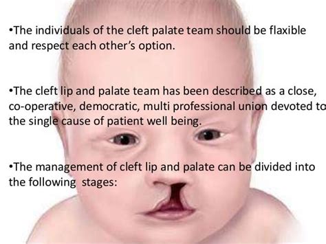 Management Of Cleft Lip And Palate