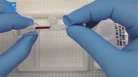 Lysing Fingerstick Whole Blood for MedMira POC Rapid Test - YouTube