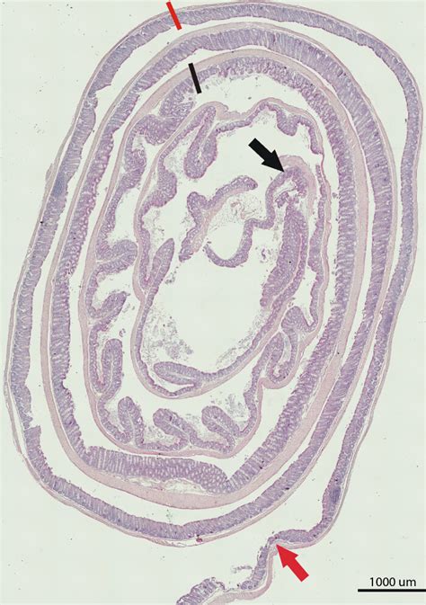 Improved Swiss Rolling Technique For Intestinal Tissue Preparation For Immunohistochemical And