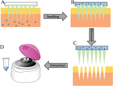 HydrogelForming Microneedles Current Advancements And Future Trends