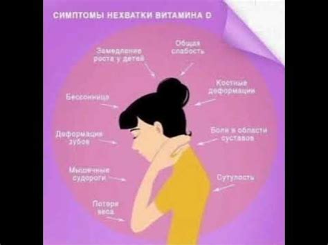 Симптомы нехватки витамина Д👆 - YouTube