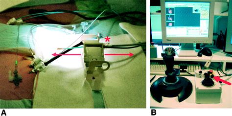 Initial Experience With Remote Catheter Ablation Using A Novel Magnetic Navigation System