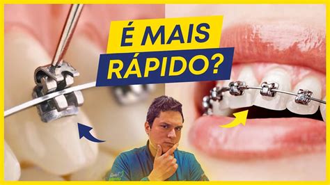 COMO FUNCIONA O APARELHO AUTOLIGADO É VERDADE QUE É MAIS RÁPIDO YouTube