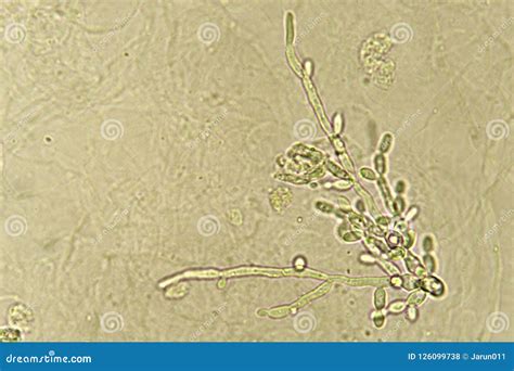 Yeast Urine