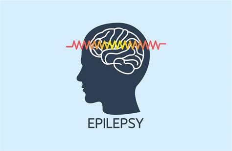 What Is Epilepsy? What Causes Seizures?