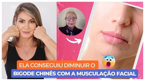 Ela Conseguiu Diminuir O Bigode ChinÊs Com A MusculaÇÃo Facial Youtube