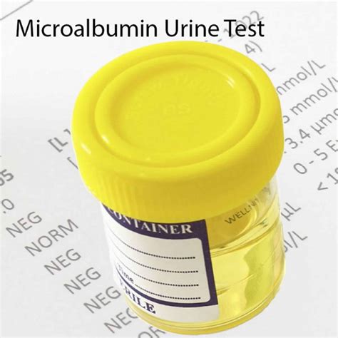 Microalbumin or urine microalbumin test & urine microalbumin creatinine ratio