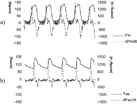 A Left Ventricular Pressure Plv And Its Dime Derivative B Radial