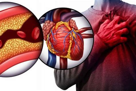 8 Super Cibi Che Puliscono Le Arterie E Abbassano Il Colesterolo