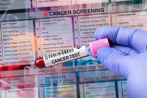 Cancer screenings lag pre-pandemic levels