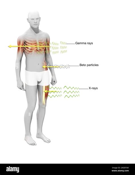 Les Effets Des Rayonnements Sur L Homme De L Illustration Trois Types