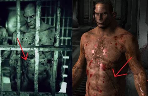 Image The Brothers Scars Outlast Wiki Fandom Powered By Wikia