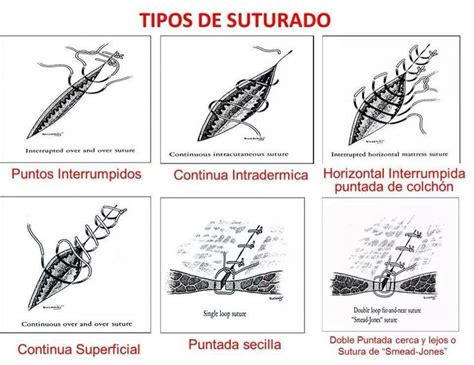 Suturas Medical School Essentials Emergency Medicine Nursing Students