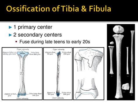 Ppt The Pelvic Girdle Powerpoint Presentation Id 2199308