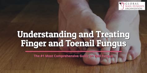 The Ultimate Guide to Understanding and Treating Finger and Toenail ...