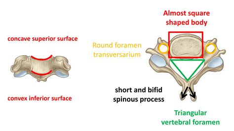 Solution Lec 2 Cervical Vertebrae Studypool