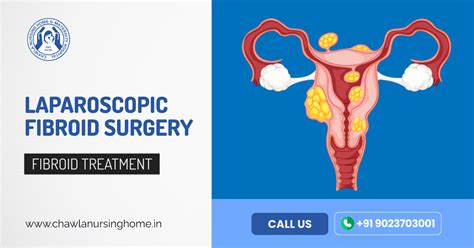 Best Doctor For Uterine Fibroids Treatment In Jalandhar Myomectomy