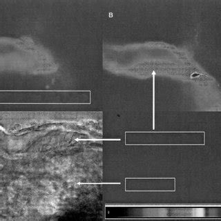 Changes in macula densa pH i induced by altering tubular NaCl... | Download Scientific Diagram