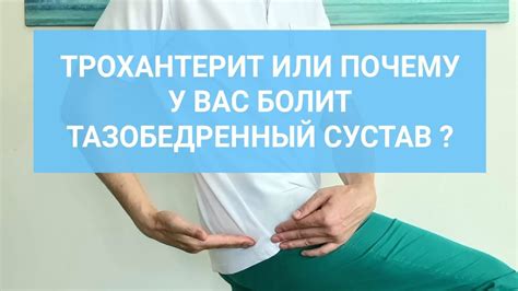 ТРОХАНТЕРИТ ИЛИ ПОЧЕМУ У ВАС БОЛИТ ТАЗОБЕДРЕННЫЙ СУСТАВ - YouTube