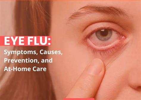 Eye Flu Symptoms Causes Prevention And At Home Care