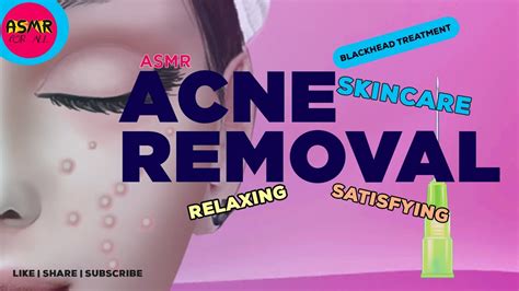 Satisfying Blackhead Treatment Asmr Skincare Animation Acne Removal